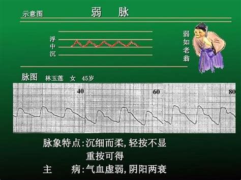 脈細數|中醫詳解：脈象之浮、沉、滑、數